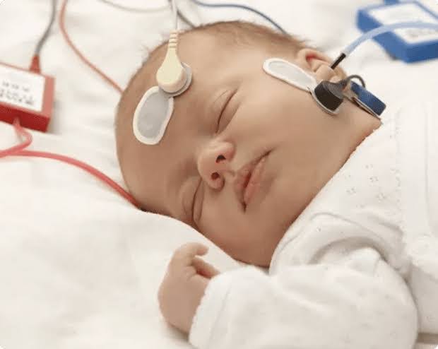 Importance of BERA Test for Hearing Loss